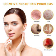 24K Gold Tearing Mask Blackhead Suction